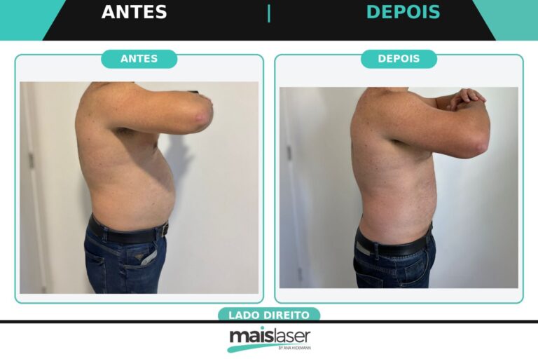 Direito - 2 sessões